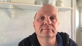 Erik Schacks ene halvdel af hjernen er kun beskyttet af hud, indtil han f&aring;r indopereret en ny hjerneskal. 