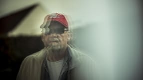 En r&aelig;kke l&aelig;ger og eksperter vurderer, at 54-&aring;rige Allan Delugas problemer er senf&oslash;lger af en hjernerystelse. Men en l&aelig;gekonsulent i Arbejdsmarkedets Erhvervssikring mener, at en arbejdsulykke, hvor Allan Deluga slog hovedet, blot har forv&aelig;rret en "forudbest&aring;ende hovedpine".  