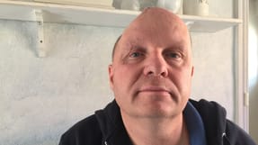 Erik Schack fik blodpropper i hjernen og har ad flere omgange f&aring;et fjernet en del af sin hjerneskal og f&aring;et den sat p&aring; igen. Han har meget nedsat f&oslash;rlighed p&aring; grund af ulykken i 2014.