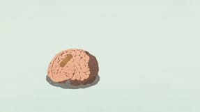 Dokumentation er afg&oslash;rende, hvis man skal bevise, at det er arbejdet, der er &aring;rsagen til, at man er g&aring;et psykisk ned. 