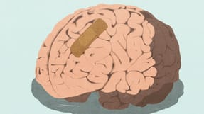 Her er fem gode r&aring;d til, hvad du b&oslash;r dokumentere, hvis arbejdet skader din psyke. 