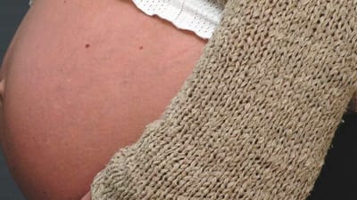 En gravid serviceassistent har f&aring;et 85.000 kroner i godtg&oslash;relse, da hun blev opsagt under sin graviditet.
