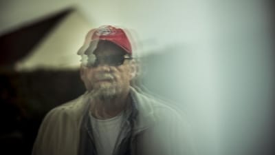 En r&aelig;kke l&aelig;ger og eksperter vurderer, at 54-&aring;rige Allan Delugas problemer er senf&oslash;lger af en hjernerystelse. Men en l&aelig;gekonsulent i Arbejdsmarkedets Erhvervssikring mener, at en arbejdsulykke, hvor Allan Deluga slog hovedet, blot har forv&aelig;rret en "forudbest&aring;ende hovedpine".  