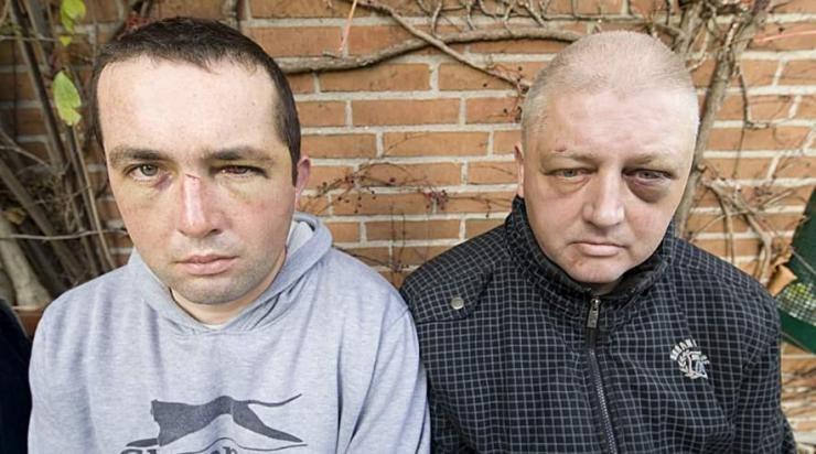To polske byggearbejdere og 3F'ere, Marek og Andrzej, blev gennembanket med køller og jernrør af en chef.