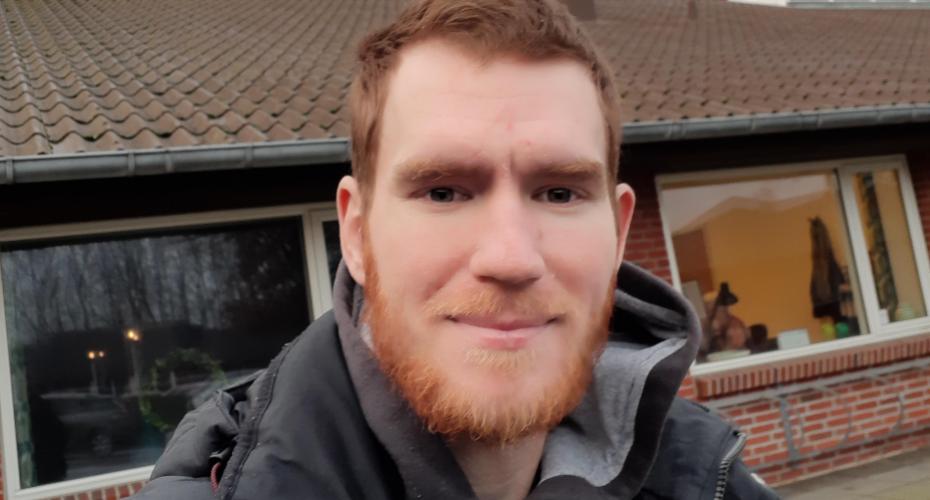 Den 30-årige ukrainer Andrii Ikin blev i 2018 udsat for en alvorlig arbejdsskade som landbrugspraktikant på en gård i Danmark