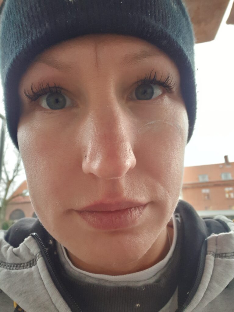 - Jeg kan komme hjem, lave aftensmad, dække bordet og give ungerne mad. Og så er jeg nødt til at ligge ned, siger 37-årige Megan Stern Fussing, der har tre børn i alderen 6 til 13 år.  