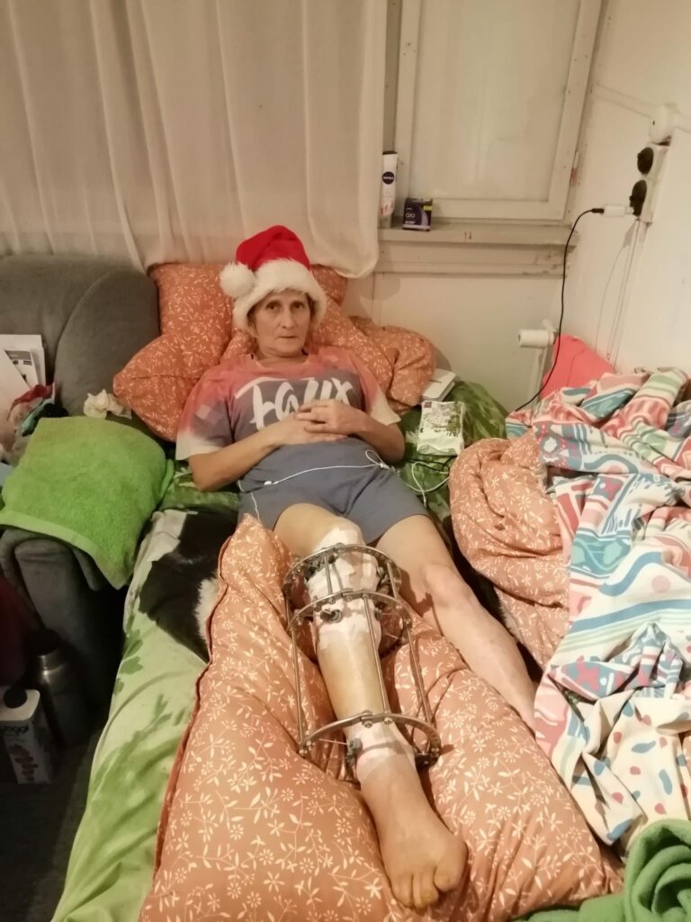- Jeg håber, at jeg kommer til at gå ordentligt igen uden krykker. Jeg vil have mit gamle liv tilbage, siger 58-årige Aija Skuja, der kom til skade med sit højre ben på jobbet i Danmark. 